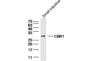 Mouse small intestine lysate (40ug) probed with CBR1 Polyclonal Antibody, unconjugated  at 1:300 overnight at 4°C followed by a conjugated secondary antibody for 60 minutes at 37°C. (CBR1 antibody  (AA 201-277))