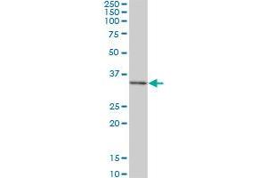 DKK1 monoclonal antibody (M02), clone 1F5. (DKK1 antibody  (AA 81-180))