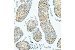 IHC analysis of PDCD6IP using anti-PDCD6IP antibody (ABIN7600490).