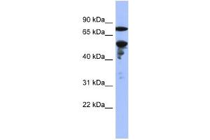 WB Suggested Anti-ZNF549 Antibody Titration:  0. (ZNF549 antibody  (Middle Region))