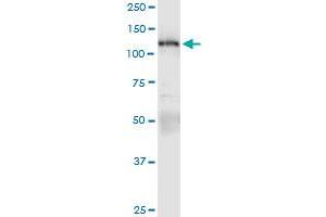 Immunoprecipitation of PKN1 transfected lysate using anti-PKN1 MaxPab rabbit polyclonal antibody and Protein A Magnetic Bead , and immunoblotted with PKN1 purified MaxPab mouse polyclonal antibody (B01P) . (PKN1 antibody  (AA 1-942))