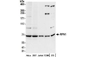 Western Blotting (WB) image for anti-Ribophorin 1 (RPN1) (AA 557-607) antibody (ABIN7452970)