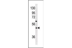 Western blot analysis of anti-NP1(Nptx1) Antibody (Center) (ABIN391417 and ABIN2841412) in Jurkat cell line lysates (35 μg/lane). (NPX1 antibody  (AA 174-203))