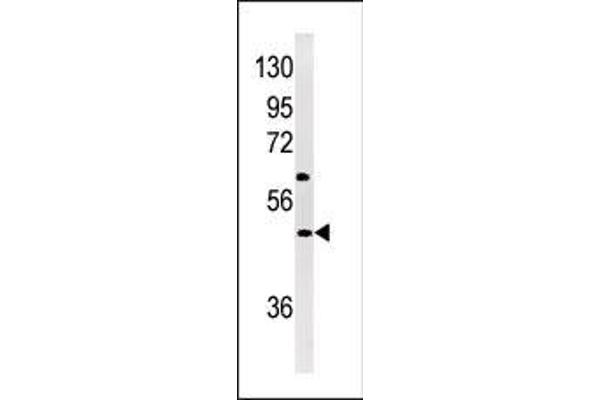 NPX1 anticorps  (AA 174-203)