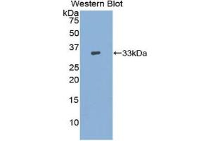 Western blot analysis of the recombinant protein. (ADCY9 antibody  (AA 1029-1282))
