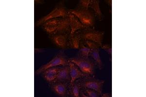 Immunofluorescence analysis of U-2 OS cells using ENAH antibody (ABIN7266936) at dilution of 1:100. (ENAH antibody  (AA 412-591))