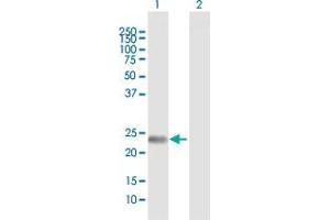 Western Blot analysis of FNDC4 expression in transfected 293T cell line by FNDC4 MaxPab polyclonal antibody. (FNDC4 antibody  (AA 1-234))