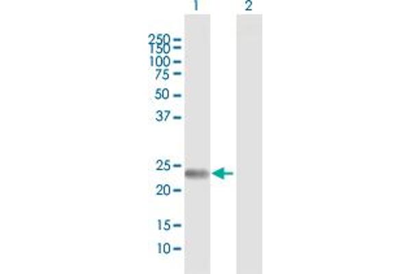FNDC4 antibody  (AA 1-234)