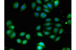 Immunofluorescent analysis of A549 cells using ABIN7145071 at dilution of 1:100 and Alexa Fluor 488-congugated AffiniPure Goat Anti-Rabbit IgG(H+L) (COQ8B antibody  (AA 10-137))