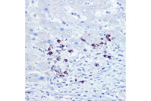 Immunohistochemistry (IHC) image for anti-Toll-Like Receptor 9 (TLR9) (AA 350-450) antibody (ABIN7270849)