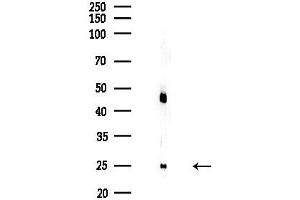 anti-Homeobox A11/D11 (HOXA11 + HOXD11) antibody