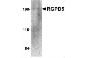 Western blot analysis of RGPD5 in human thymus tissue lysate with this product at 1 μg/ml. (RGPD5 / RGPD6 (N-Term) antibody)