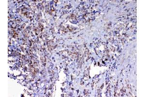 IHC analysis of MAVS using anti-MAVS antibody .