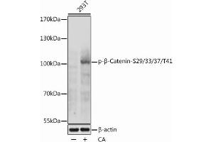 Western blot analysis of extracts of 293T cells, using Phospho-β-Catenin-S29/33/37/T41 antibody (ABIN7266139) at 1:1000 dilution.