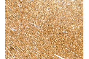 ABIN7094599 and ABIN7098649 at 1/100 staining Rat heart tissue by IHC-P.
