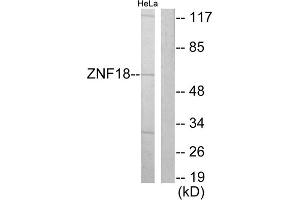 Western blot analysis of extracts from HeLa cells, using ZNF18 antibody. (ZNF18 antibody  (Internal Region))