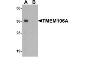 Western blot analysis of TMEM106A in A-20 cell lysate with TMEM106A Antibody  at 1 µg/ml in (A) the absence and (B) the presence of blocking peptide. (TMEM106A antibody  (N-Term))