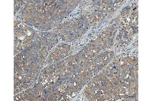 IHC analysis of SNX1 using anti-SNX1 antibody (ABIN7602548).