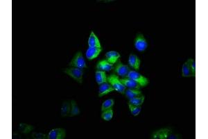 Immunofluorescence staining of Hela cells with ABIN7171484 at 1:133, counter-stained with DAPI. (TLN1 antibody  (AA 92-399))