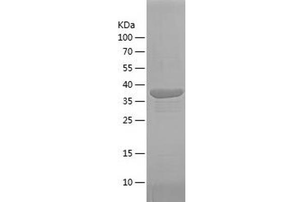 FAM3C Protein (AA 96-227) (His-IF2DI Tag)