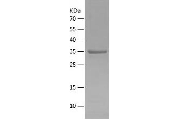 OCT4 Protein (AA 233-360) (His-IF2DI Tag)