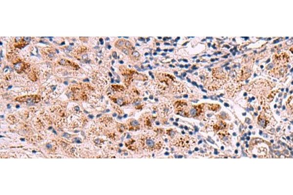 INPP5B antibody
