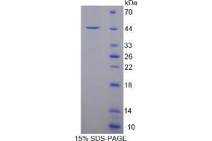 Image no. 1 for Synuclein, gamma (Breast Cancer-Specific Protein 1) (SNCG) (AA 1-121) protein (His tag,GST tag) (ABIN6236708) (SNCG Protein (AA 1-121) (His tag,GST tag))