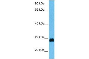 Host:  Mouse  Target Name:  PDX1  Sample Tissue:  Mouse Testis  Antibody Dilution:  1ug/ml (PDX1 antibody  (N-Term))