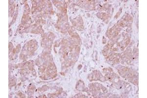 Image no. 1 for anti-Protein Phosphatase, EF-Hand Calcium Binding Domain 1 (PPEF1) (AA 361-650) antibody (ABIN1500360) (PPEF1 antibody  (AA 361-650))