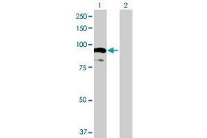 Lane 1: AOC2 transfected lysate ( 83. (AOC2 293T Cell Transient Overexpression Lysate(Denatured))