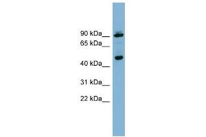 WIPI1 antibody used at 1 ug/ml to detect target protein. (WIPI1 antibody  (Middle Region))