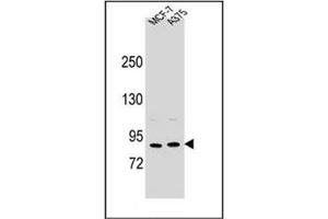Western blot analysis of Periostin Antibody (C-term) in MCF-7, A375 cell line lysates (35ug/lane). (Periostin antibody  (C-Term))