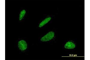 Immunofluorescence of monoclonal antibody to DBF4 on HeLa cell. (DBF4 antibody  (AA 2-98))