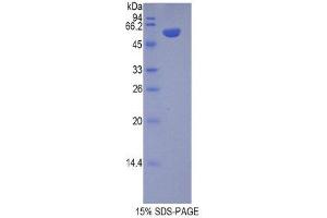SDS-PAGE (SDS) image for Chromogranin B (Secretogranin 1) (CHGB) (AA 40-326) protein (His tag,GST tag) (ABIN1878510) (CHGB Protein (AA 40-326) (His tag,GST tag))