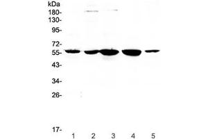 Western blot testing of human 1) placenta, 2) HeLa, 3) 22RV1, 4) SKOV and 5) A549 lysate with ETV6 antibody at 0. (ETV6 antibody)