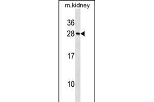 Mouse Rcvrn Antibody (N-term) (ABIN1539345 and ABIN2838308) western blot analysis in mouse kidney tissue lysates (35 μg/lane). (Recoverin antibody  (N-Term))
