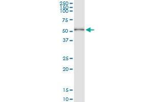 Immunoprecipitation of HDAC3 transfected lysate using anti-HDAC3 MaxPab rabbit polyclonal antibody and Protein A Magnetic Bead , and immunoblotted with HDAC3 MaxPab mouse polyclonal antibody (B01) . (HDAC3 antibody  (AA 1-428))