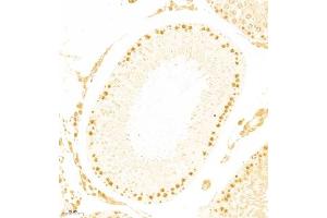 Immunohistochemistry of paraffin embedded rat testis using APOBEC4 (ABIN7073086) at dilution of 1:800 (200x lens)
