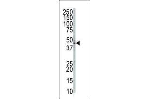 The anti-GPI8 Pab (ABIN389064 and ABIN2839269) is used in Western blot to detect GPI8 in 293 cell lysate. (PIGK antibody  (N-Term))