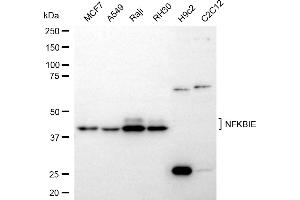 Western blotting analysis using NFKBIE antibody (ABIN7799644).