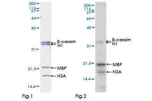 Kinase Activity Assay (KAA) image for zeta-Chain (TCR) Associated Protein Kinase 70kDa (ZAP70) (AA 1-493) protein (GST tag) (ABIN1325570)