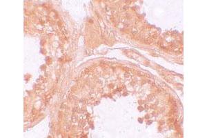 Immunohistochemical staining of human testis cells with NLRP9 polyclonal antibody  at 10 ug/mL. (NLRP9 antibody  (N-Term))