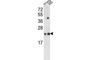 Western blot analysis of SAR1A Antibody (Center) in 293, NCI-H460 cell line and mouse lung tissue lysates (35ug/lane). (SAR1A antibody  (Middle Region))