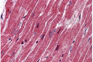 Human Heart: Formalin-Fixed, Paraffin-Embedded (FFPE) (Nestin antibody  (AA 1295-1344))