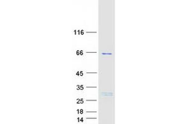 TBC1D3C Protein (Myc-DYKDDDDK Tag)