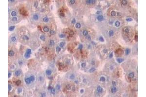 Detection of SHH in Mouse Liver Tissue using Polyclonal Antibody to Hedgehog Homolog, Sonic (SHH) (Sonic Hedgehog antibody  (AA 28-193))