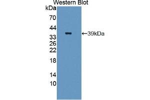 Detection of Recombinant FN3K, Human using Polyclonal Antibody to Fructosamine-3-Kinase (FN3K)