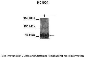 Lanes:   100 ug CHO cell lysate  Primary Antibody Dilution:   1:1000  Secondary Antibody:   Goat anti-rabbit HRP  Secondary Antibody Dilution:   1:25000  Gene Name:   KCNQ4  Submitted by:   Anonymous (KCNQ4 antibody  (Middle Region))