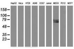 Image no. 2 for anti-Butyrylcholinesterase (BCHE) antibody (ABIN1496836)