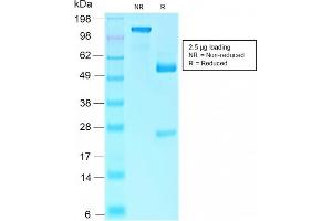 SDS-PAGE Analysis Purified Retinoblastoma Recombinant Rabbit Monoclonal Antibody (RB1/2313R). (Recombinant Retinoblastoma 1 antibody)